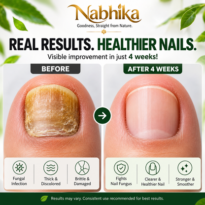 Nabhika™ Nail Repair Oil